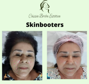 Dra Cassia Borba - Botox, Harmonização Facial Clinica de Estética Facial e Corporal