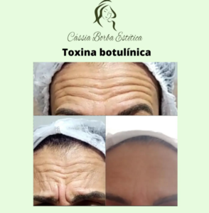 Dra Cassia Borba - Botox, Harmonização Facial Clinica de Estética Facial e Corporal