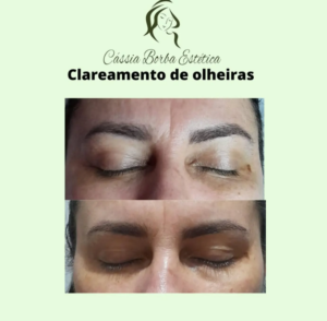 Dra Cassia Borba - Botox, Harmonização Facial Clinica de Estética Facial e Corporal