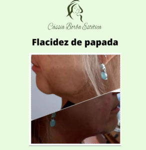 Dra Cassia Borba - Botox, Harmonização Facial Clinica de Estética Facial e Corporal