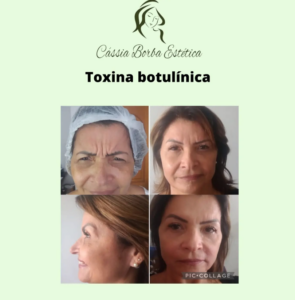 Dra Cassia Borba - Botox, Harmonização Facial Clinica de Estética Facial e Corporal