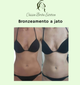 Dra Cassia Borba - Botox, Harmonização Facial Clinica de Estética Facial e Corporal