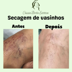 Dra Cassia Borba - Botox, Harmonização Facial Clinica de Estética Facial e Corporal