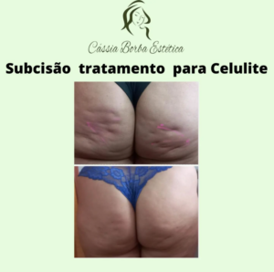 Dra Cassia Borba - Botox, Harmonização Facial Clinica de Estética Facial e Corporal